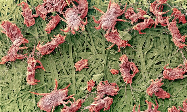 Dust mites